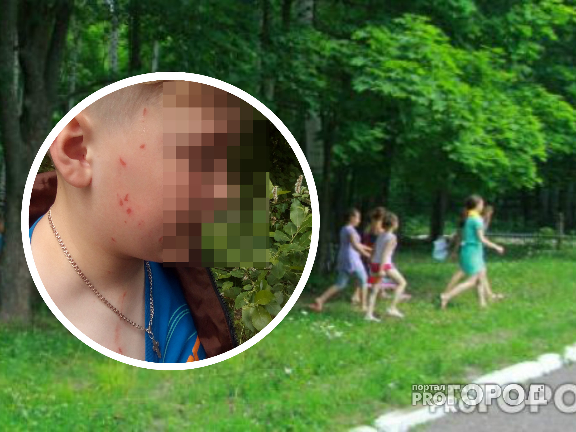 В мальчика из Новочебоксарска в летнем лагере кидали камнями