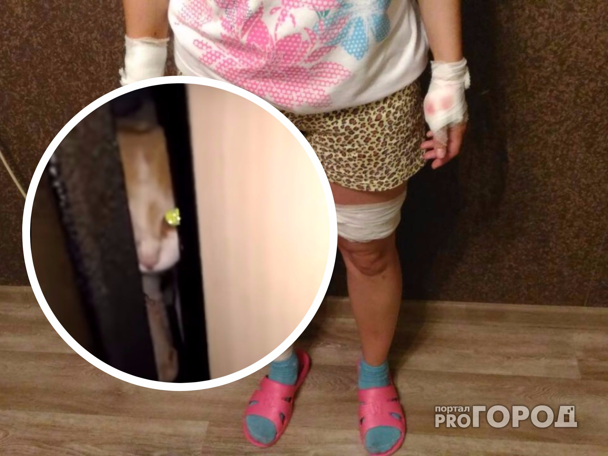 В Новочебоксарске кошка до крови искусала девушку и преследовала ее до квартиры