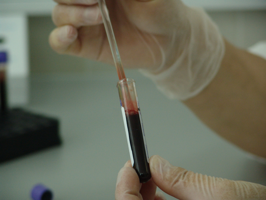 Где можно сдать кровь на гепатит в чебоксарах