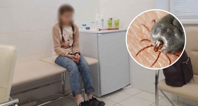 В Новочебоксарске 11-летнюю девочку укусил энцефалитный клещ