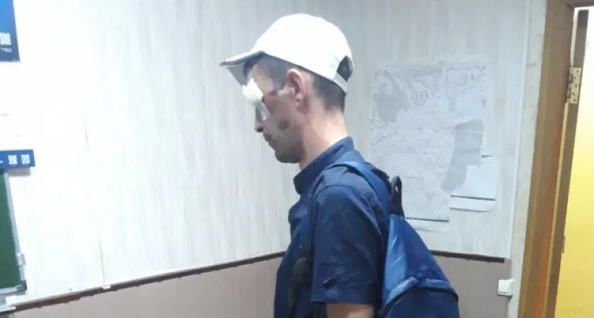 Фото к статье: В Чебоксарах мужчина покалечил себя, угнав сломанный велосипед