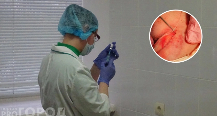 Фото к статье: В Чебоксарах врачи помогли девочке, которую собака укусила за лицо