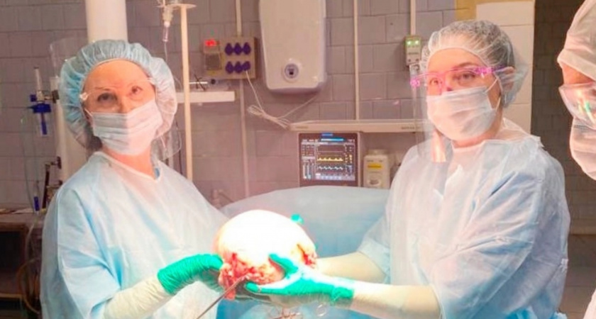 В Чебоксарах врачи удалили у женщины пятикилограммовую опухоль 