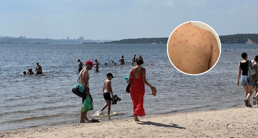 Фото к статье: В российских водоемах нашли личинок червей, которые прогрызают кожу насквозь