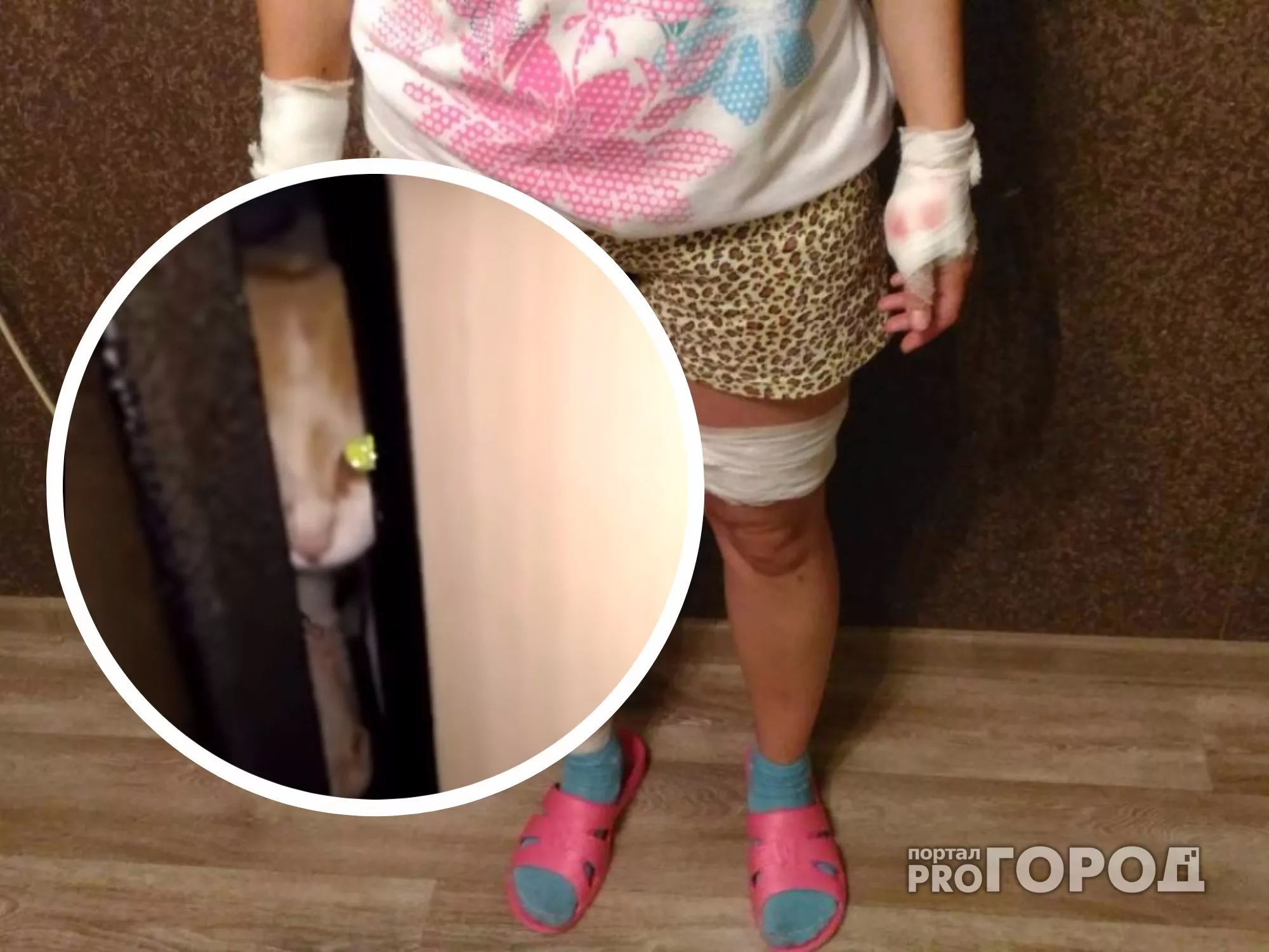 Фото к статье: В Новочебоксарске кошка до крови искусала девушку и преследовала ее до квартиры