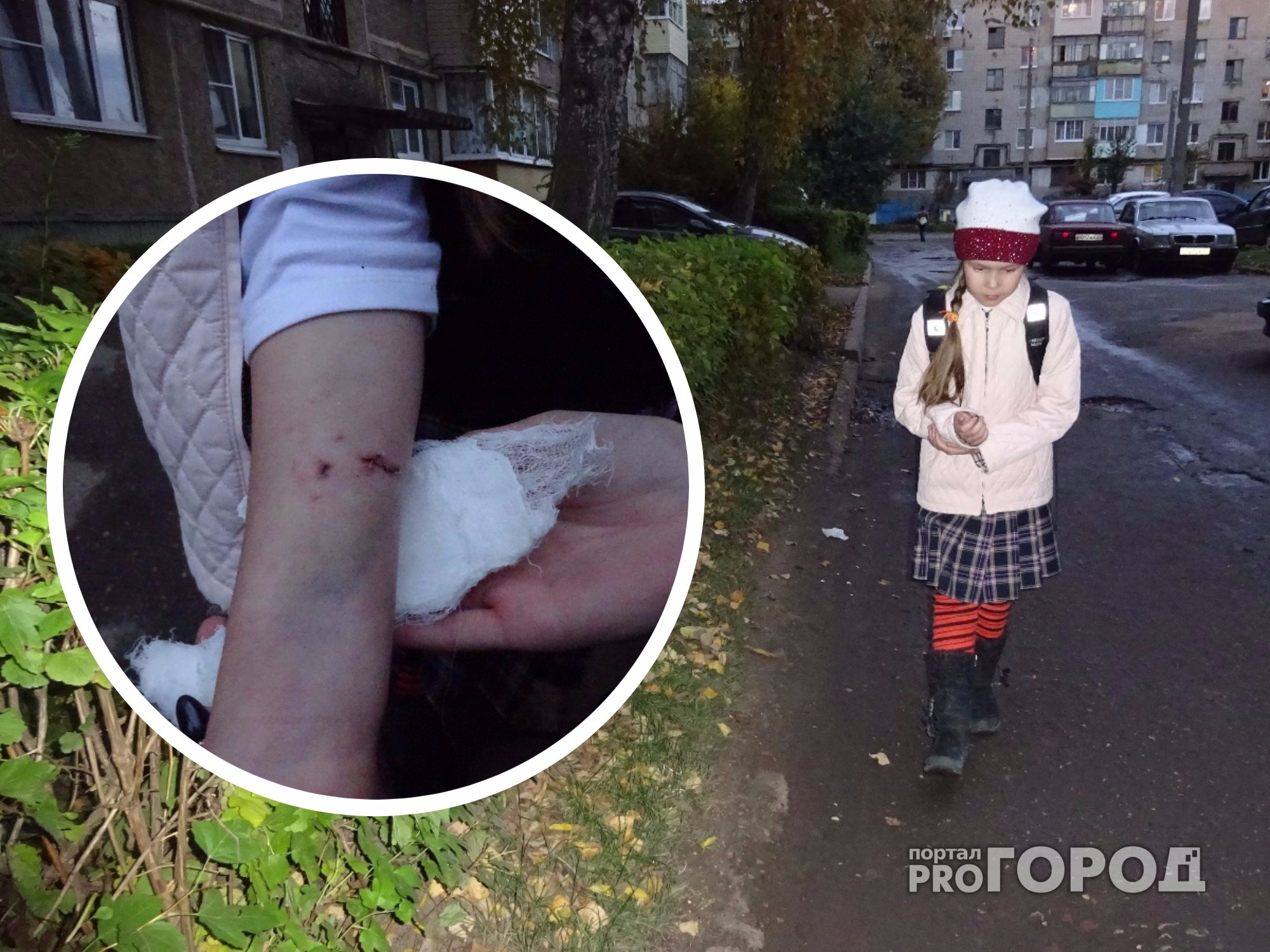В Новочебоксарске собака напала на 8-летнюю девочку и покусала ее