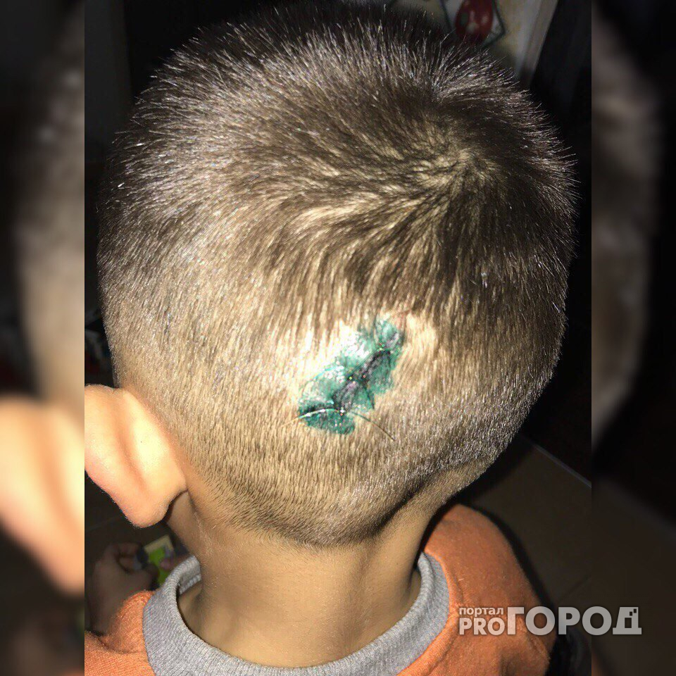 В Чебоксарах мальчик разбил голову в детском центре развлечений