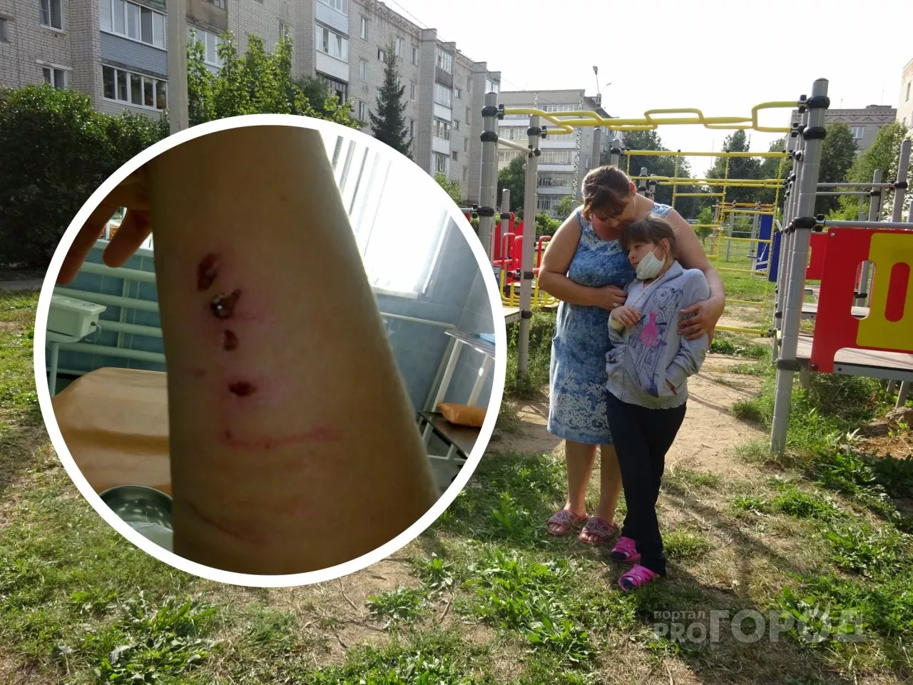 Фото к статье: В Чебоксарах собака покусала 9-летнюю девочку прямо на детской площадке