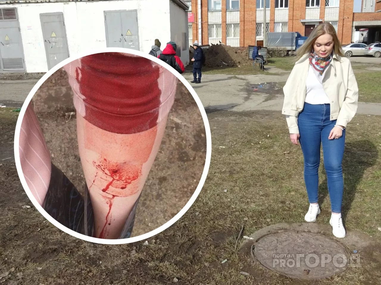 Фото к статье: В Чебоксарах девушка провалилась в канализацию и повредила ногу штырем