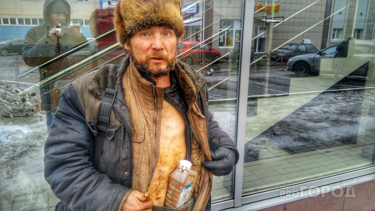 Бездомный чебоксарец стеснялся своего зловония и не обращался за помощью
