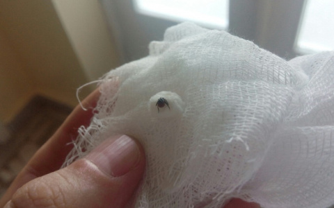 Клещи атаковали за два месяца 130 жителей Чувашии