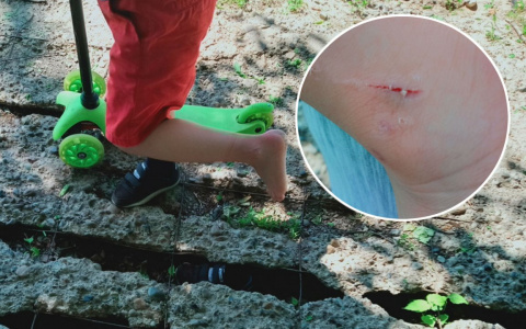 Чебоксарка о городских тротуарах: "Сын порезал ногу из-за дыры в плите"