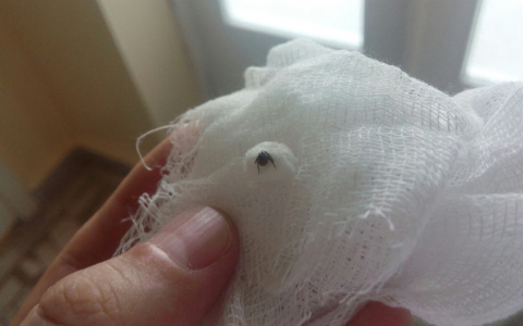 В этом году клещи активнее нападают на жителей Чувашии