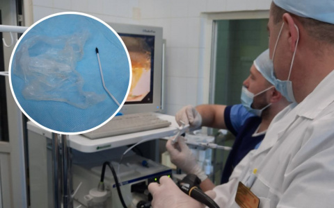 Чебоксарские врачи достали из желудка мужчины пакет и ручку