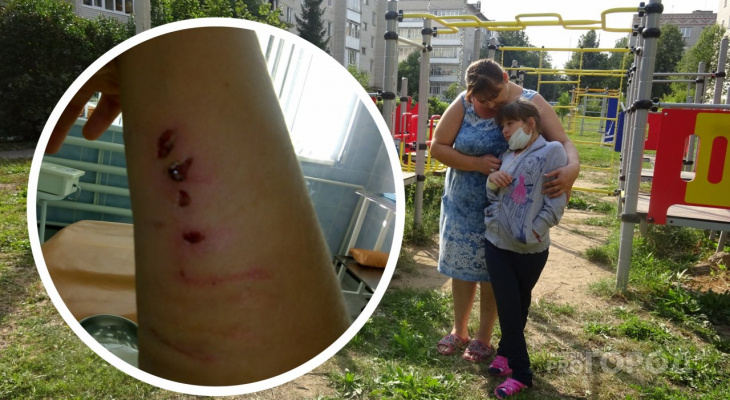 В Чебоксарах собака покусала 9-летнюю девочку прямо на детской площадке