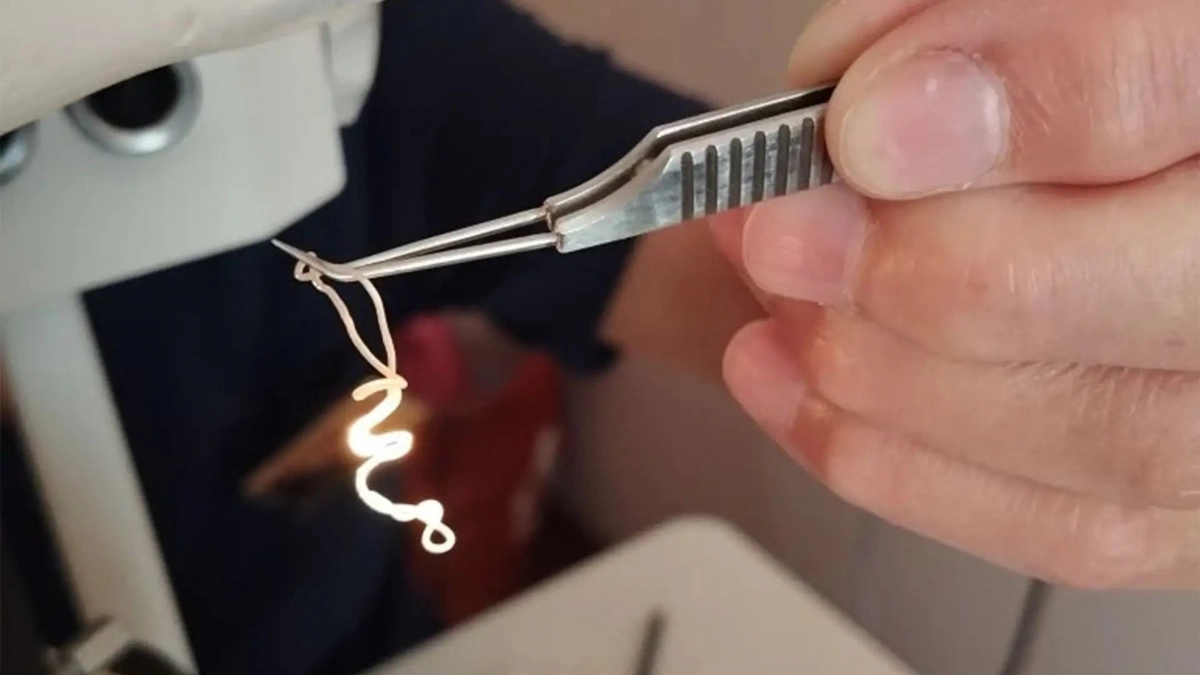 После укуса комара в глазу мужчины поселился червь: он рос и стал длиной почти 20 сантиметров