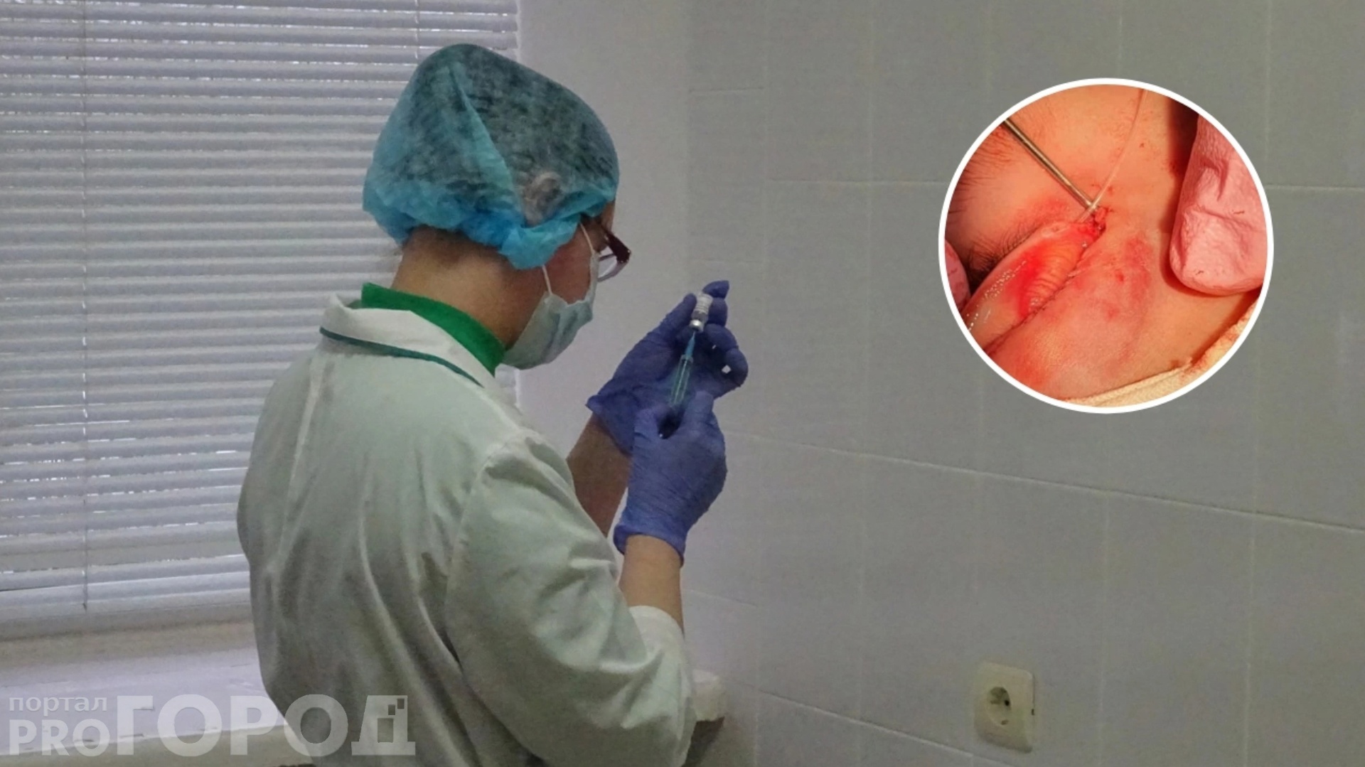 В Чебоксарах врачи помогли девочке, которую собака укусила за лицо