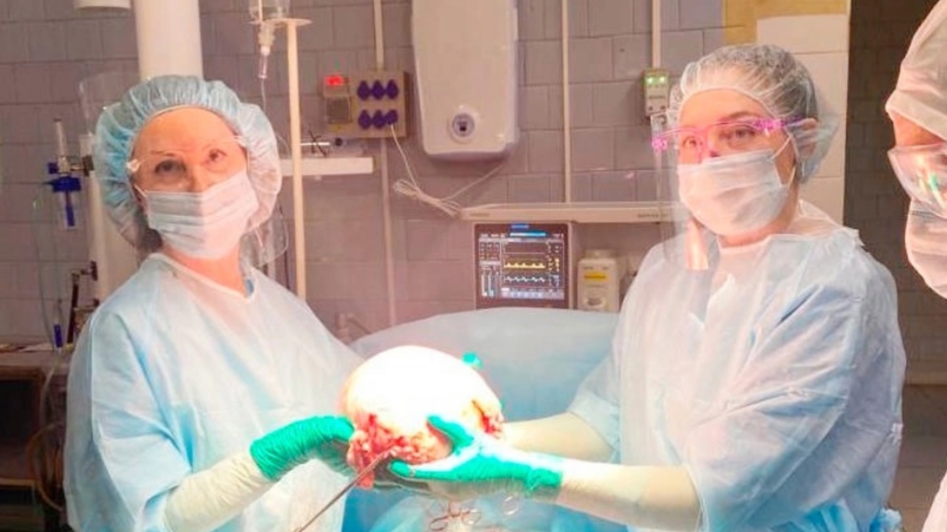 В Чебоксарах врачи удалили у женщины пятикилограммовую опухоль 